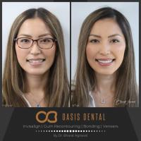 Oasis Dental Studio - Palm Beach image 3